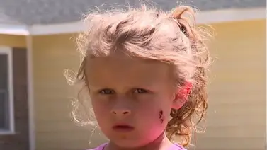 EEUU: Niña de seis años, baleada en la cara, pidió esto para su agresor EEUU: Niña de seis años, baleada en la cara, pidió esto para su agresor
