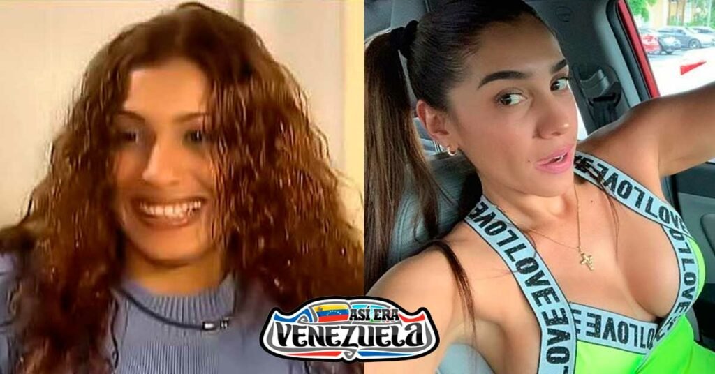 La "Coconaza" Gladiuska Acosta antes y después de las cirugías La "Coconaza" Gladiuska Acosta antes y después de las cirugías