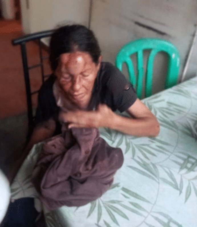 Golpeó brutalmente a su mamá en Maracaibo: La mujer le negó dinero para comprar drogas