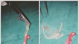 ¡Mundo loco! Estos preservativos se desviaron en pleno sexo oral