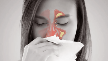 Descongestiona los senos paranasales y adiós sinusitis