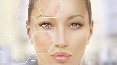 ¿Problemas en la piel? Podrías padecer de psoriasis