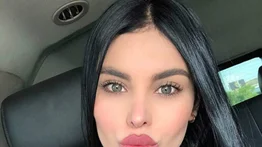 ¡La reina tiene sus retoquitos! El antes y después de Ninoska Vásquez
