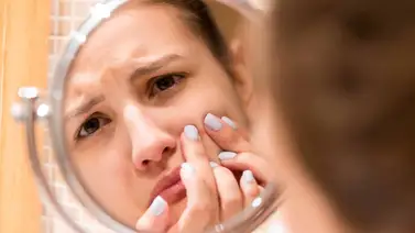 ¿Las emociones afectan la piel? ¿Las emociones afectan la piel?