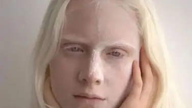 ¿Ya te enteraste? El Gobierno de Puerto Rico creó una política pública para los albinos ¿Ya te enteraste? El Gobierno de Puerto Rico creó una política pública para los albinos