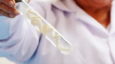 Cómo se transmiten los parásitos intestinales Cómo se transmiten los parásitos intestinales