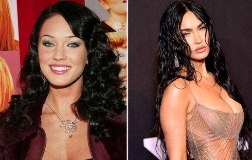 Estas estrellas famosas decidieron ser bellas con ayuda de las cirugías plásticas