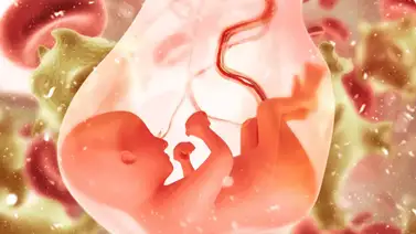 Tres principales problemas con el líquido amniótico Tres principales problemas con el líquido amniótico