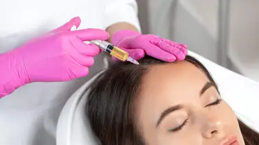 Tratamiento capilar con plasma Tratamiento capilar con plasma