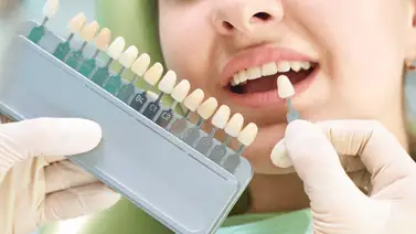 Disminuye el amarillo de tus dientes Disminuye el amarillo de tus dientes