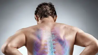 Conoce los síntomas de la hernia discal lumbar Conoce los síntomas de la hernia discal lumbar