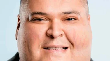 Cuáles son los síntomas del síndrome de Cushing