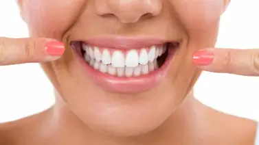 Sobre la sonrisa Sobre la sonrisa