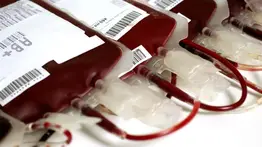 Realizan primera transfusión con sangre creada en laboratorio