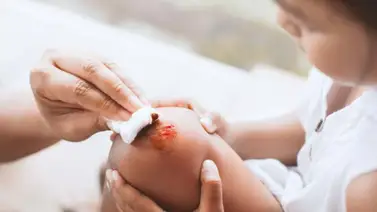 ¿Cómo curar heridas en los niños? ¿Cómo curar heridas en los niños?