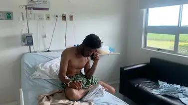 Venezolano quiso terminar la relación con su novia y esta le tiró aceite caliente en el rostro Venezolano quiso terminar la relación con su novia y esta le tiró aceite caliente en el rostro