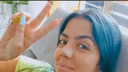 ¿Tan mal le quedó la nariz a Erika Schwarzgruber?