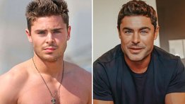 Zac Efron niega los rumores de una cirugía estética en su rostro