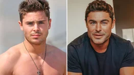 Zac Efron niega los rumores de una cirugía estética en su rostro
