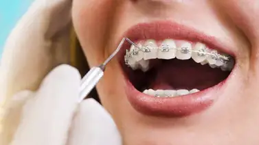 Capturan a falsa ortodoncista en el estado Carabobo Capturan a falsa ortodoncista en el estado Carabobo