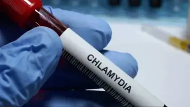 Enfermedades de transmisión sexual aumentan en un 84 % Enfermedades de transmisión sexual aumentan en un 84 %