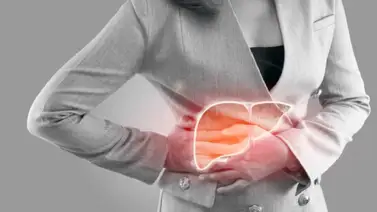 Hígado graso ¿se puede curar? Hígado graso ¿se puede curar?