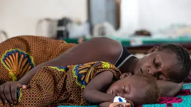 Brote de sarampión en Zimbabue deja 157 menores muertos Brote de sarampión en Zimbabue deja 157 menores muertos