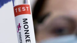 El brote de viruela del mono en países no endémicos supera los 2.000 casos