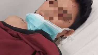 Venezolano arrolló a un joven en Perú con intención de matarlo Venezolano arrolló a un joven en Perú con intención de matarlo