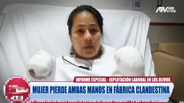 Venezolana pierde ambas manos durante accidente en una fábrica en Perú Venezolana pierde ambas manos durante accidente en una fábrica en Perú