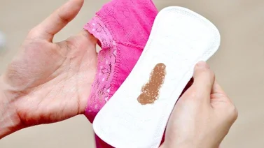 Causas del flujo vaginal marrón