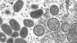 Barbados detecta su primer caso de viruela del mono