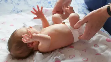 Hernia umbilical y todo lo que debes saber Hernia umbilical y todo lo que debes saber