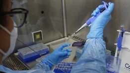 Detectan el primer caso de viruela del mono en Chile