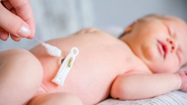 Cuidados del ombligo del recién nacido