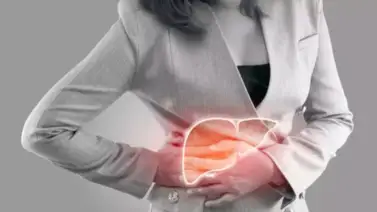 Hígado graso y sus complicaciones Hígado graso y sus complicaciones