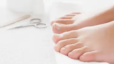 ¿Qué es un uñero y cómo se cura? ¿Qué es un uñero y cómo se cura?