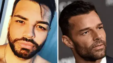 Se realizó más de 30 cirugías para parecerse a Ricky Martin Se realizó más de 30 cirugías para parecerse a Ricky Martin