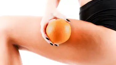 Mitos y verdades sobre la celulitis Mitos y verdades sobre la celulitis