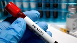 México reporta los primeros casos graves de hepatitis en niños