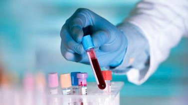 Desarrollan nuevo test de sangre que permite la detección temprana de 50 tipos de cáncer