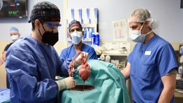 Encuentran virus en corazón de cerdo trasplantado a hombre