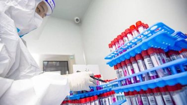 Hallan vínculos genéticos entre el COVID-19 y otras enfermedades