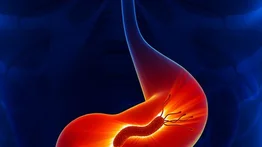 Conoce cómo sobrevive el helicobacter pylori