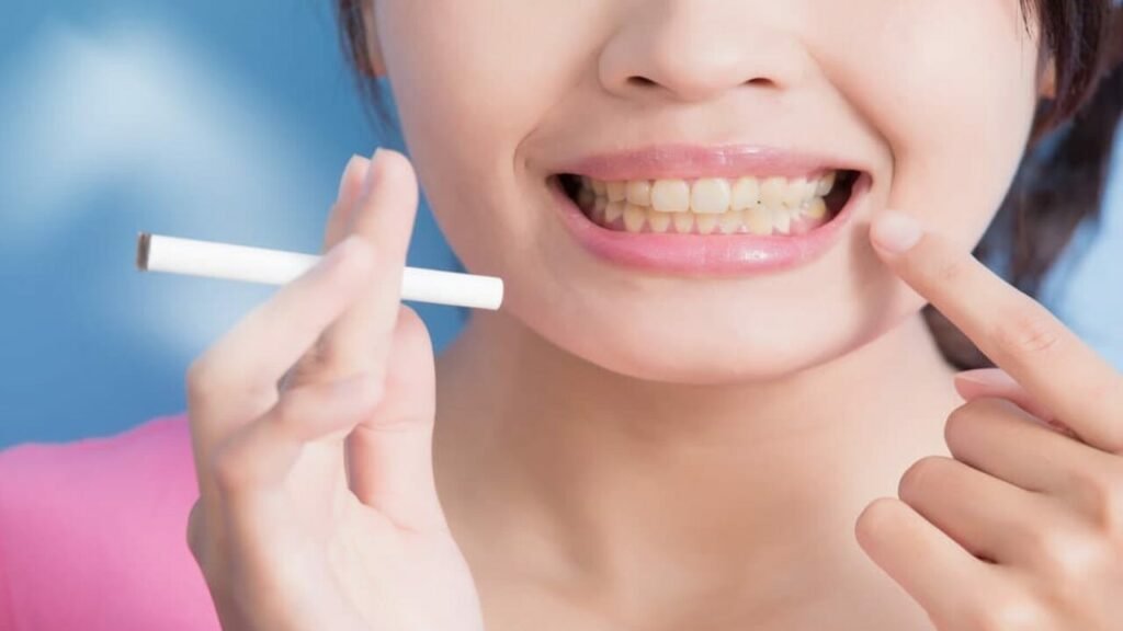 Dientes blancos usando productos naturales Dientes blancos usando productos naturales