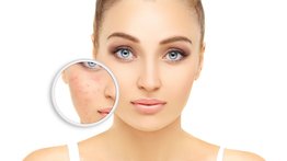 Rostro adulto con eczema