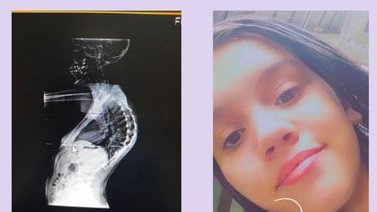 Servicio Público: Ayudemos a Angelina Gutiérrez para su operación