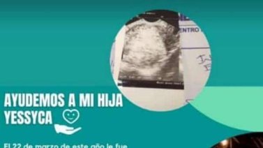 Servicio Público: Ayudemos a Yessyca para su operación