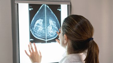 Anuncian resultados "positivos en la historia" del cáncer de mama