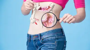 Conoce los síntomas del cáncer colorectal Conoce los síntomas del cáncer colorectal